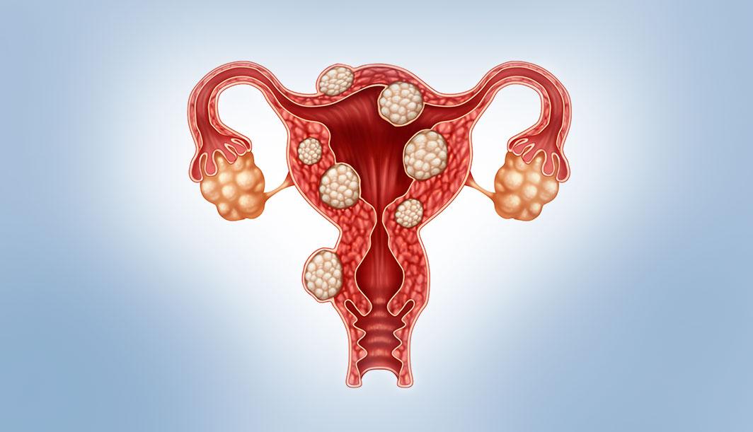 ovulation-induction