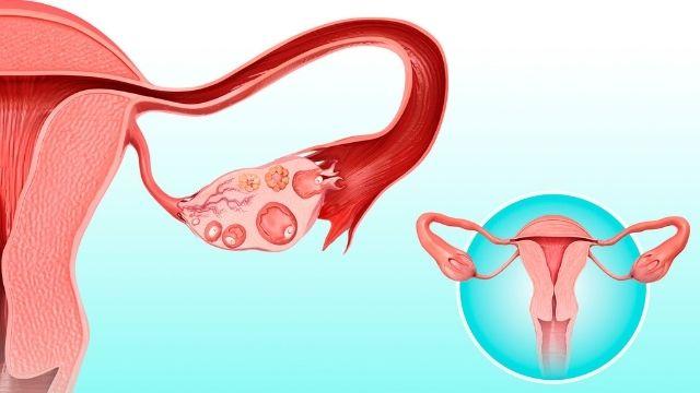 Understanding Ovulation Induction: A Key To Overcoming Infertility